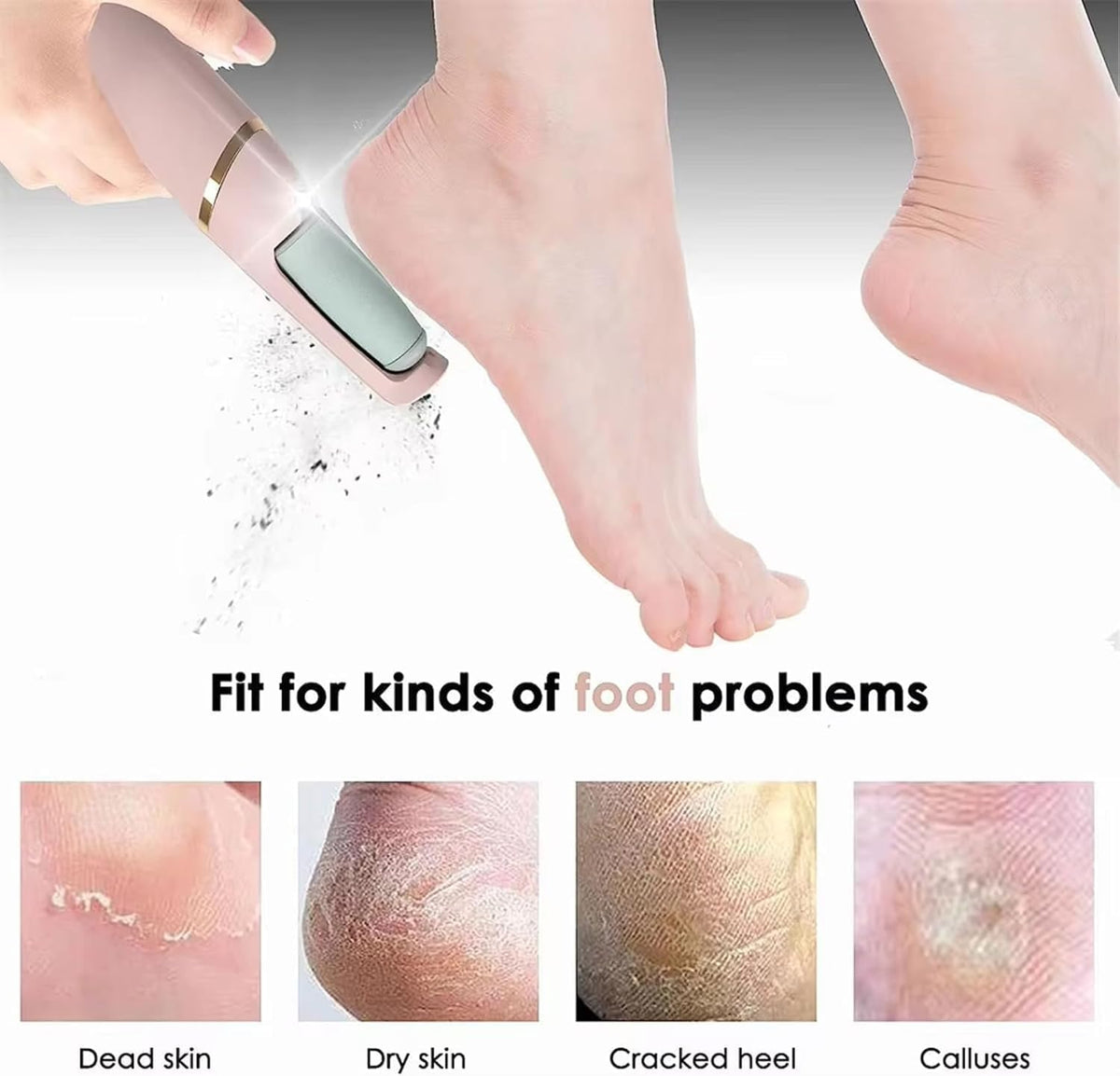 7AGAT USB rechargeable electric foot file with 2 speeds for heel callus removal, portable skin care tool with a compact design.