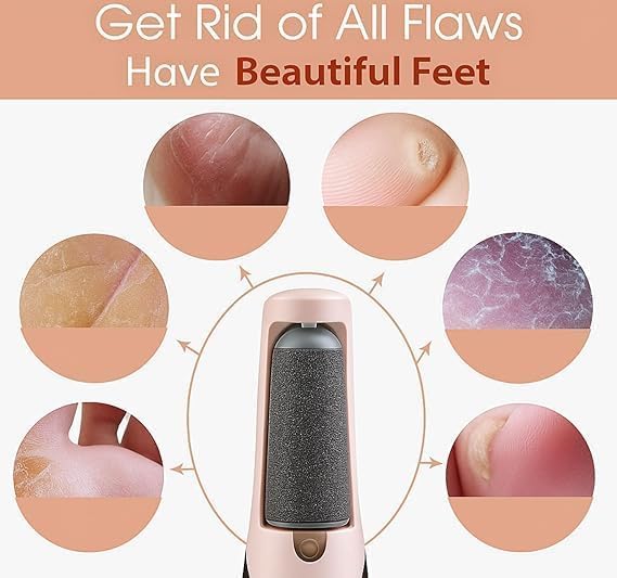 7AGAT USB rechargeable electric foot file with dual speeds for heel callus removal, portable skin care tool.