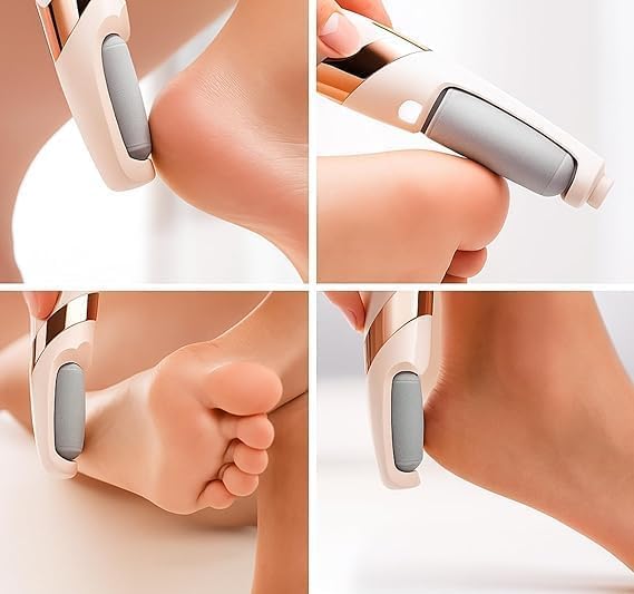 7AGAT USB rechargeable electric foot file with two speeds for heel callus removal, portable skin care tool in use.